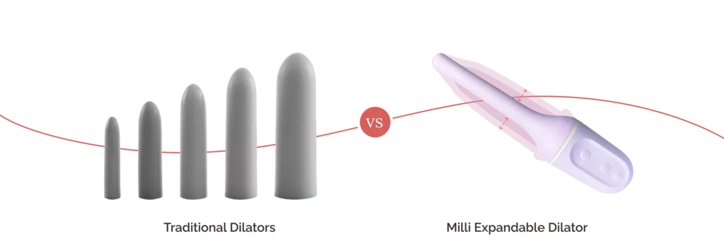 Milli dilator vs traditional set of dilators